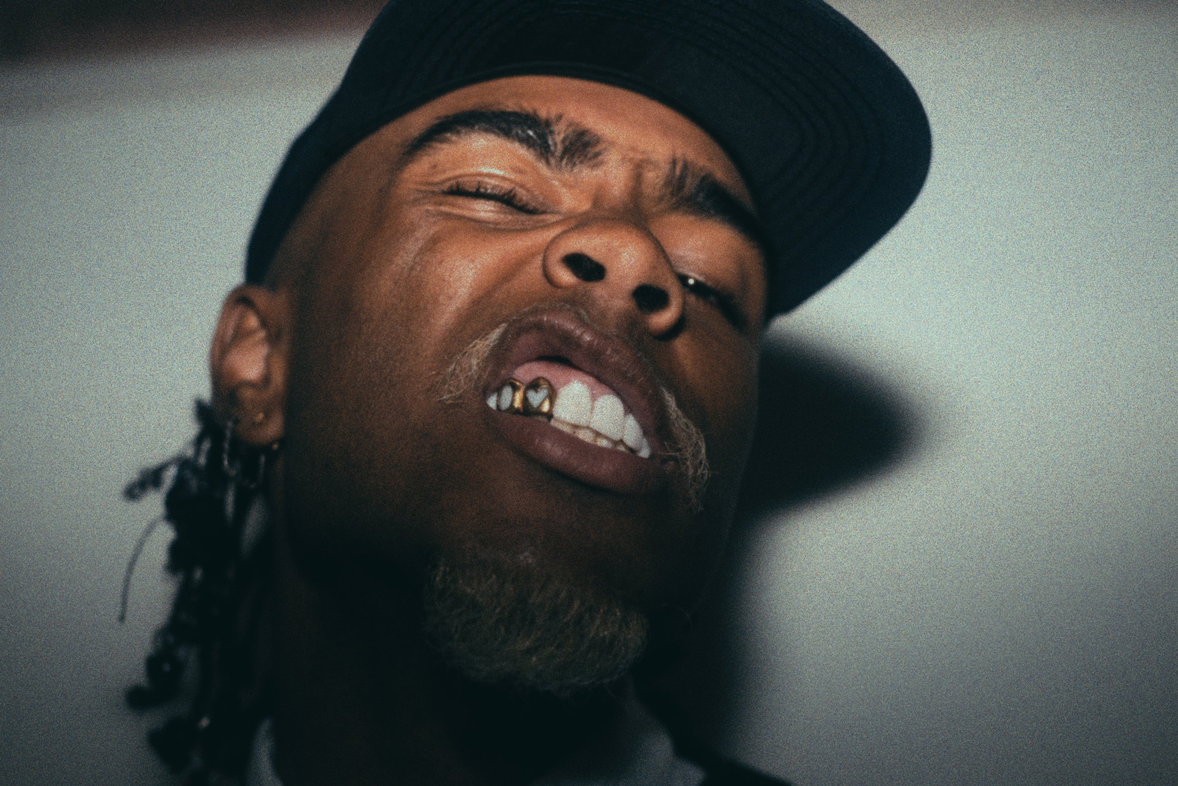 Close-up of a man in a black cap, laughing, gold teeth showing